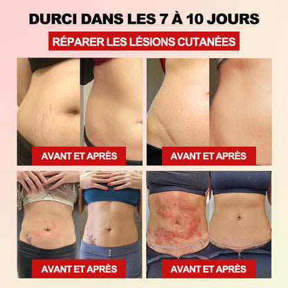 Il ne reste plus que 4 pièces ! Nous offrons maintenant une réduction supplémentaire de 30 % ! 🔥🔥 Si tu manques cette chance, tu devras attendre l'année prochaine. N'attends pas — procure-toi ta boîte maintenant !